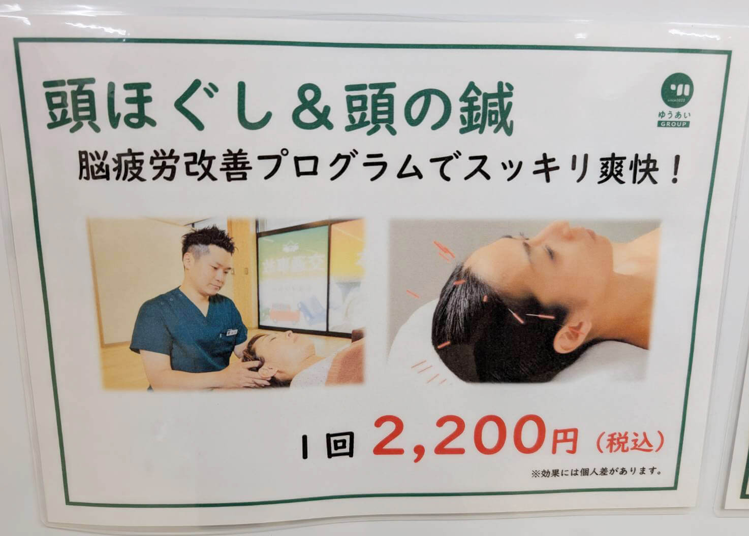 頭ほぐし＆頭の鍼の説明画像