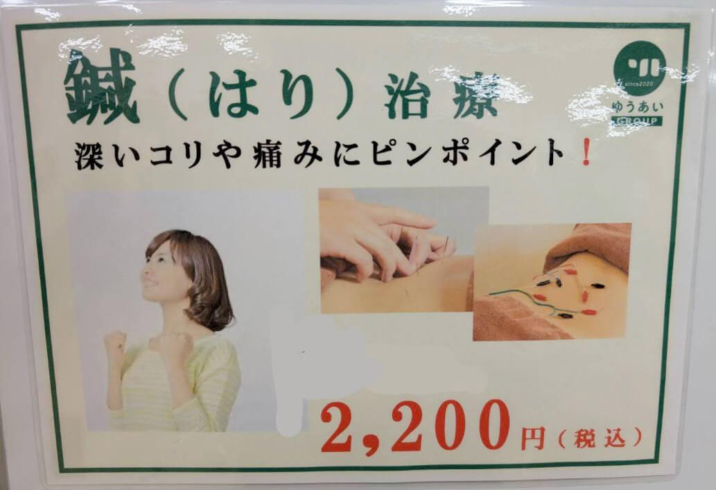 鍼（はり）治療の説明画像